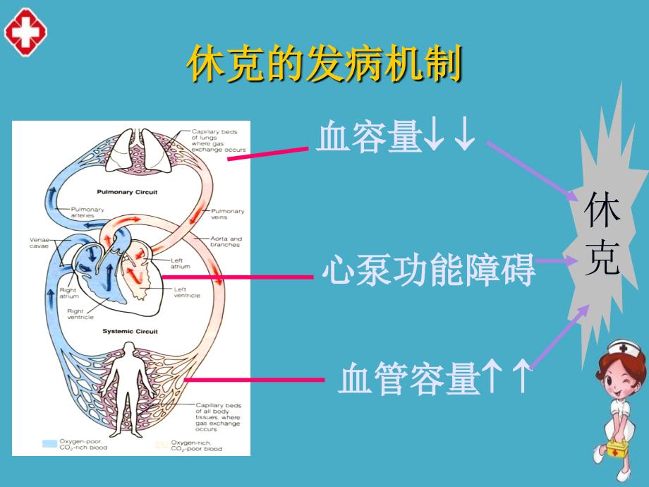 休克的急救护理ppt_第4页