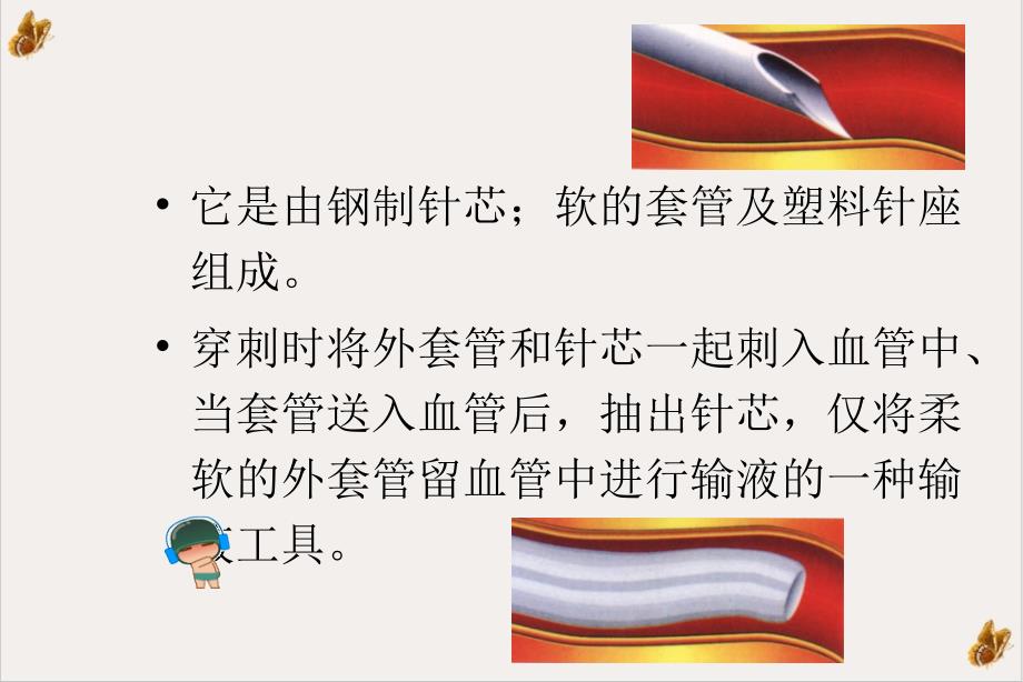 静脉留置针的穿刺技术及护理PPT幻灯片课件_第3页