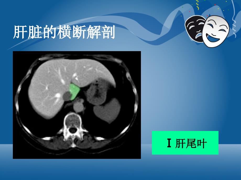 原发性肝细胞癌的CT和MRI诊断_第4页