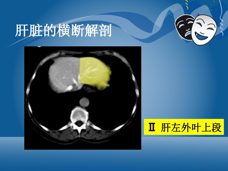 原发性肝细胞癌的CT和MRI诊断_第5页