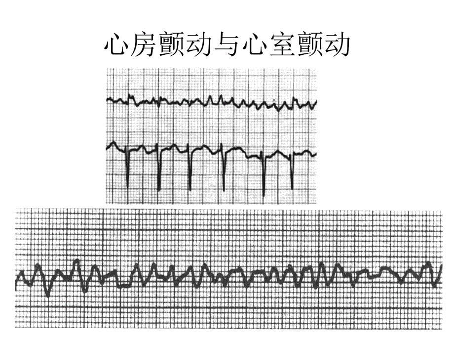 心电图练习题_第5页