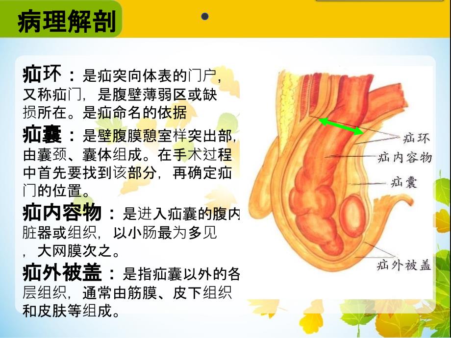 腹股沟疝手术配合_第4页