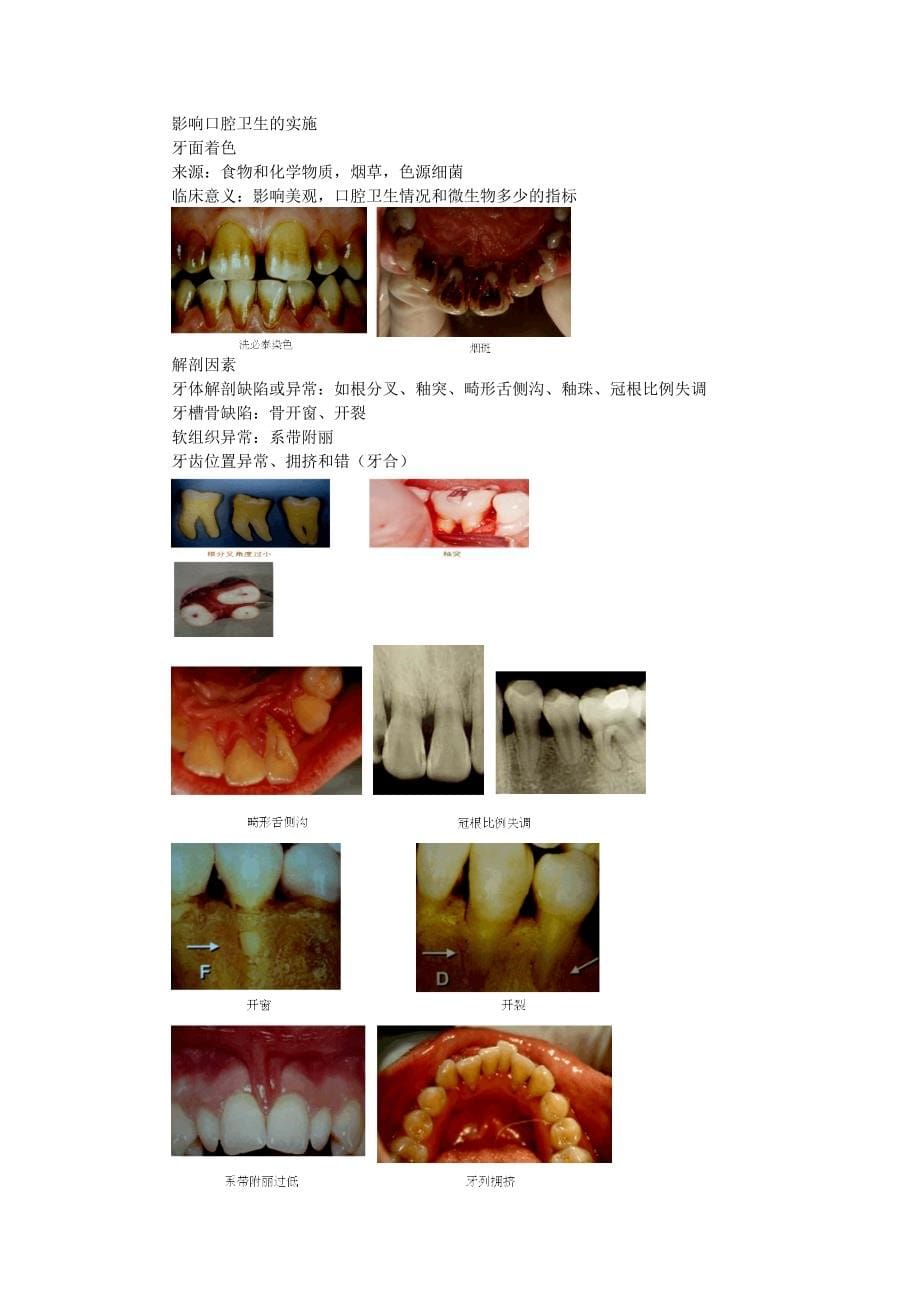 第八章 牙周病学69 (2).doc_第5页