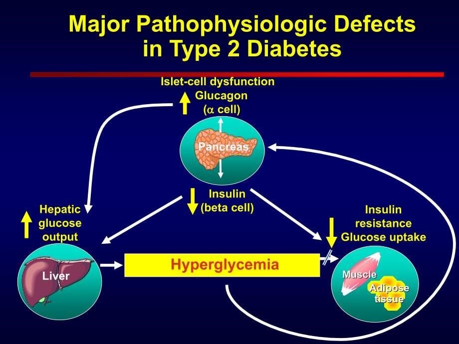 Historic Perspectives of Drug Development for Diabetes 糖尿病研究进展课件_第5页