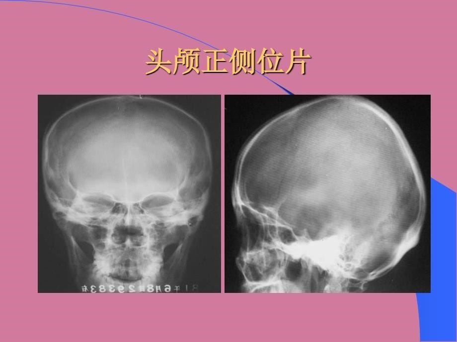 神经正常解剖ppt课件_第5页