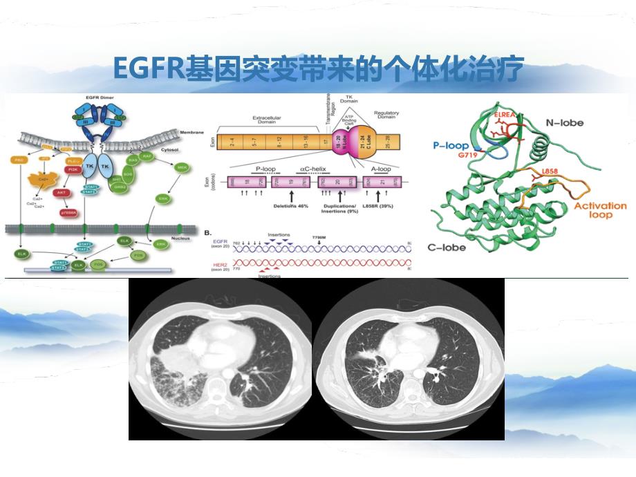 EGFR-TKI治疗NSCLC的现在与未来_第2页