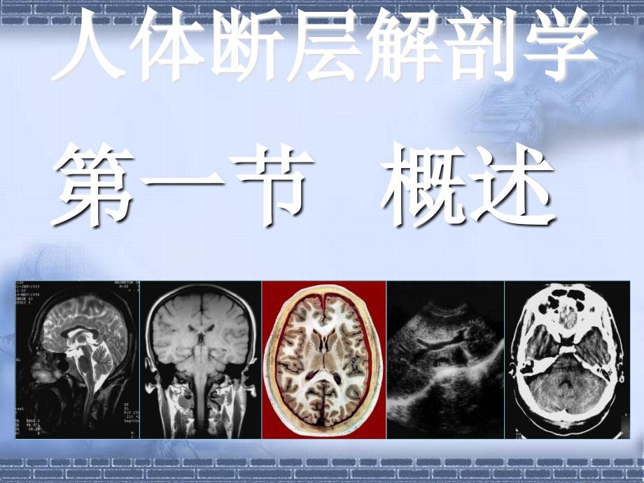 颈部断层解剖第一节概述最终_第3页