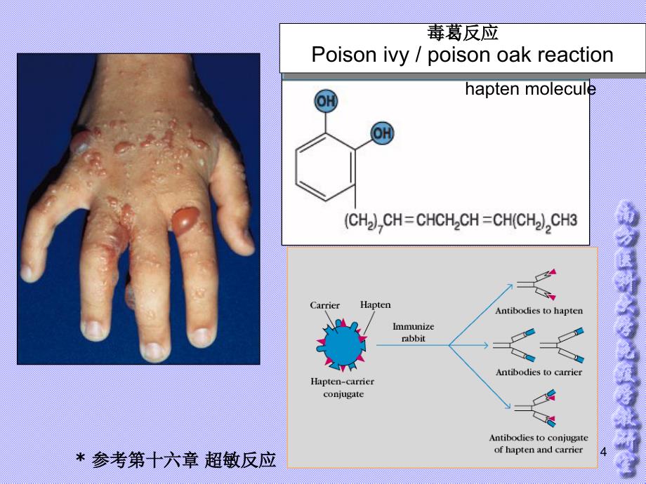 医学免疫学课件：第二章 抗 原 ( Antigen, Ag)_第4页