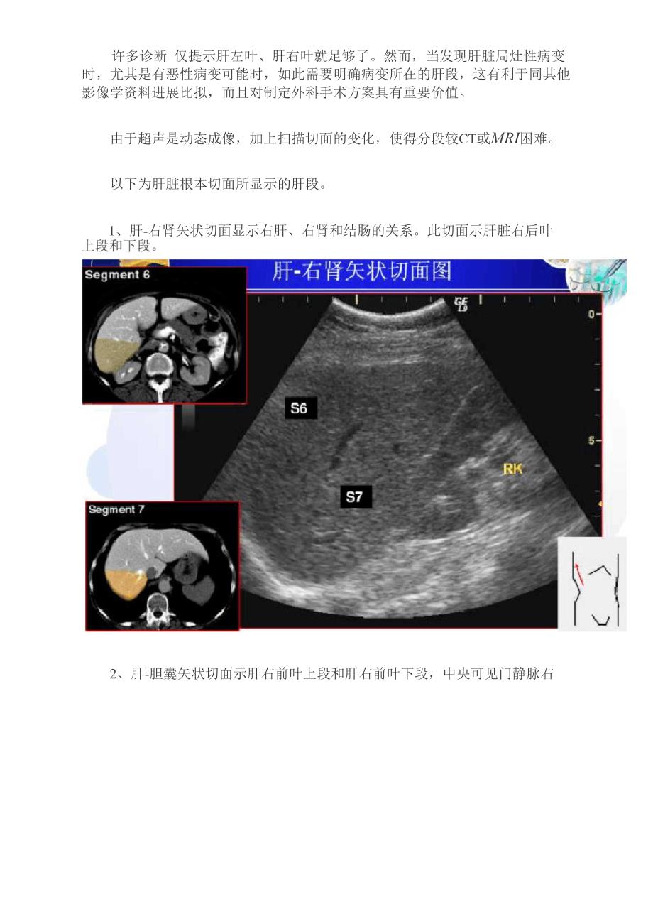 肝脏超声分段_第2页