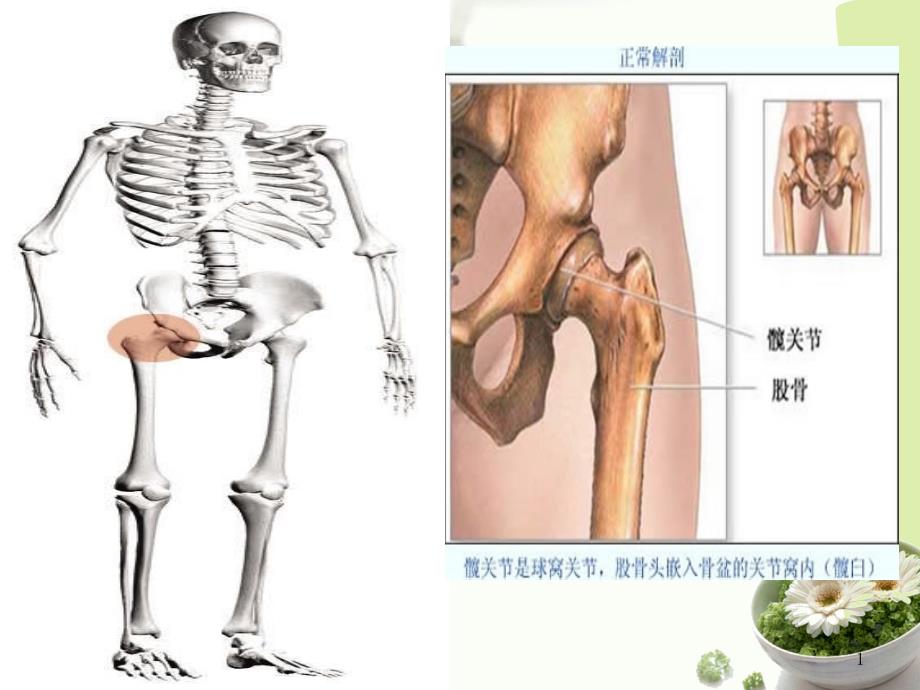 最新髋关节置换术后康复护理PPT文档_第1页