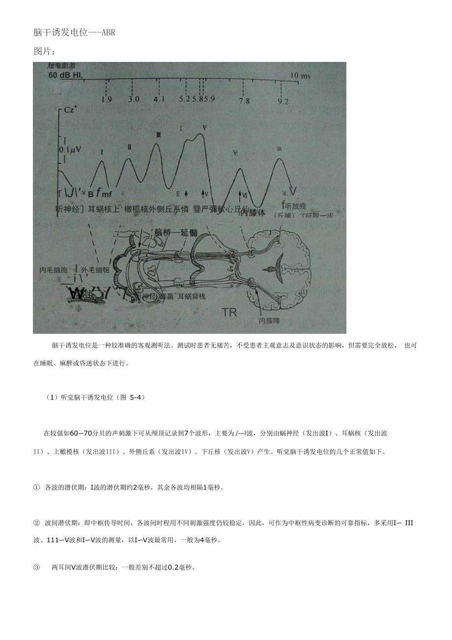 脑干诱发电位_第1页