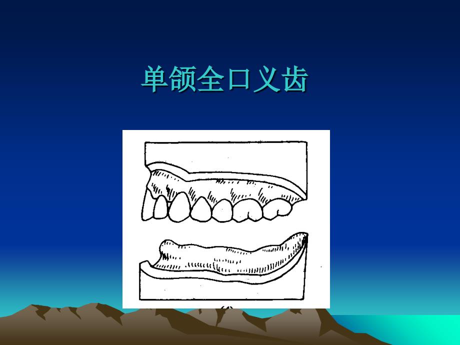 最新单颌全口义齿ppt课件_第2页