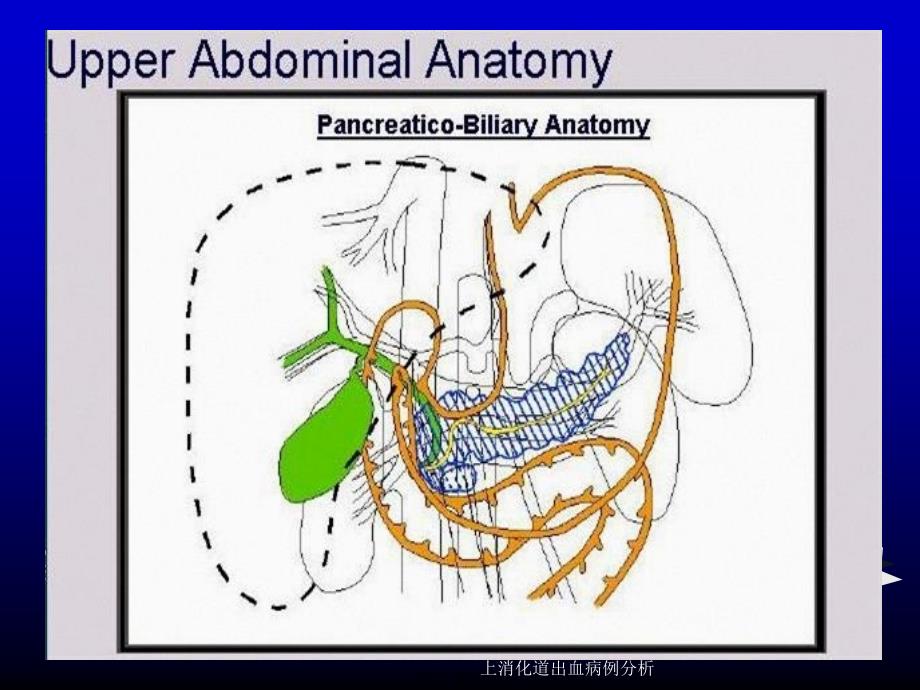 上消化道出血病例分析课件_第4页