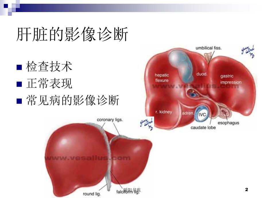 肝胆胰脾影像表现特制荟萃_第2页