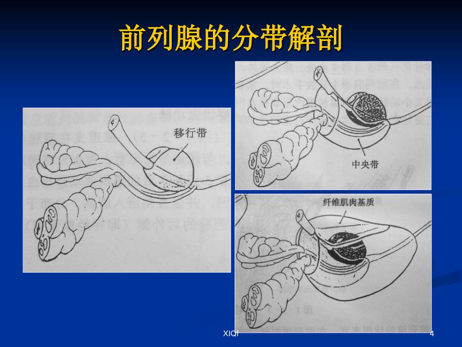 前列腺的MR检查_第4页