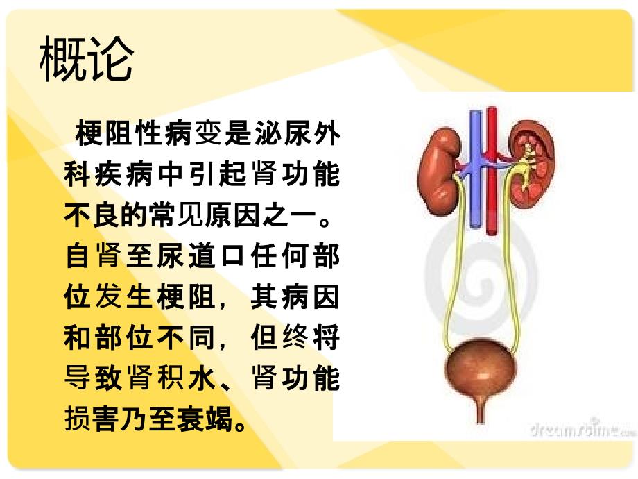 医学专题：沁尿系统梗阻_第2页