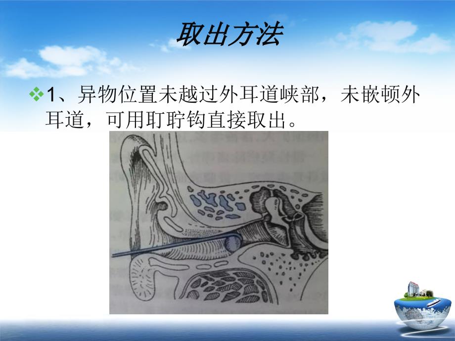 耳科常见急症处理讲座_第4页