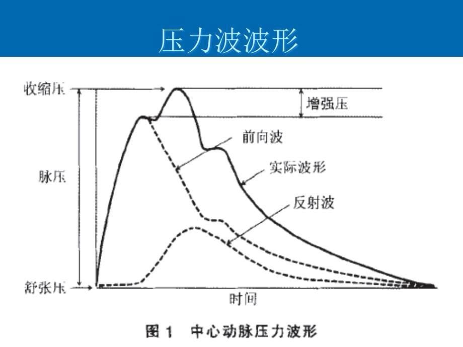 年轻人单纯收缩期高血压-中心动脉压测量的特殊意义_第5页