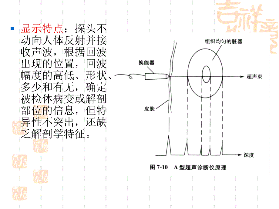 医学超声成像原理演示PPT_第5页