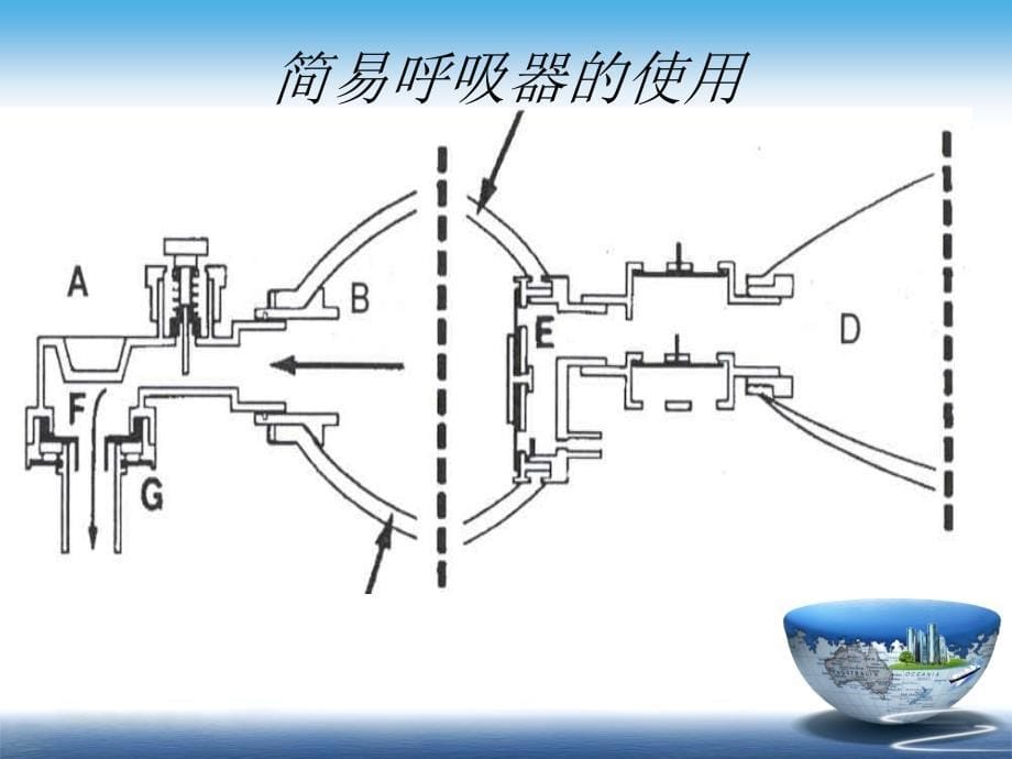 复苏囊的使用PPT_第5页