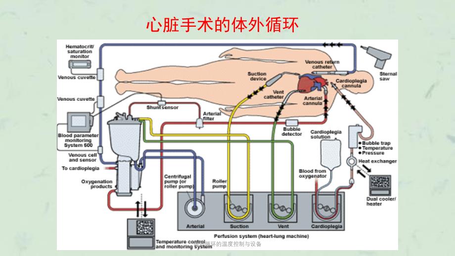 体外循环的温度控制与设备课件_第4页