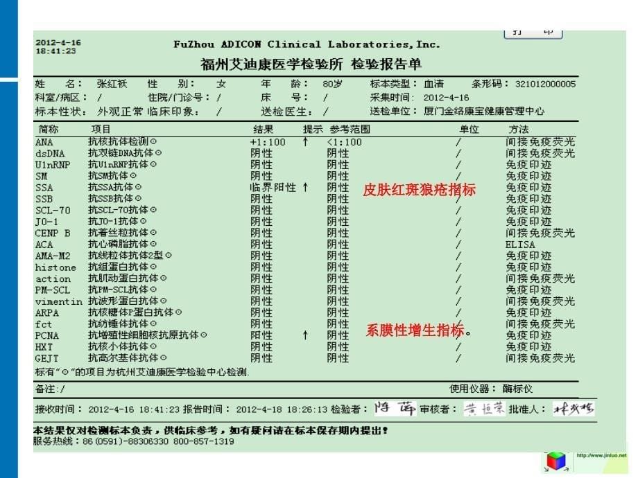 系膜增生性肾病皮肤红斑狼疮0523_第5页