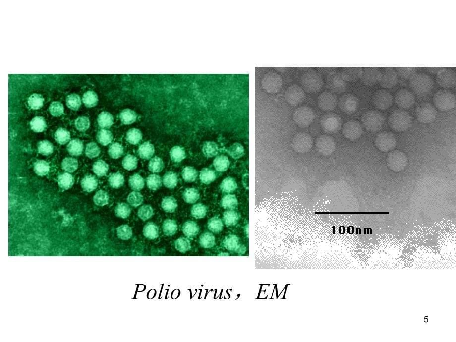 无包膜RN毒ppt课件_第5页