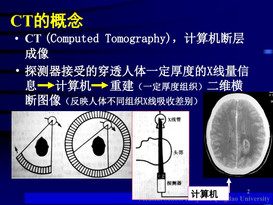 颅脑CT基础知识PPT课件_第2页