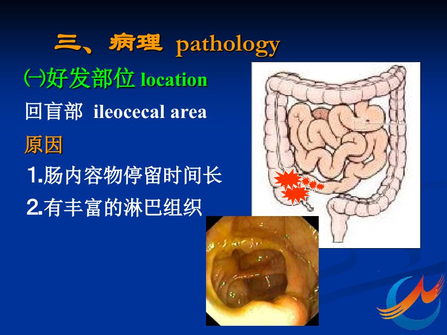 肠结核和结核性腹膜炎_第4页