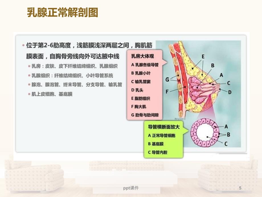 乳腺肿瘤基础知识--ppt课件_第5页