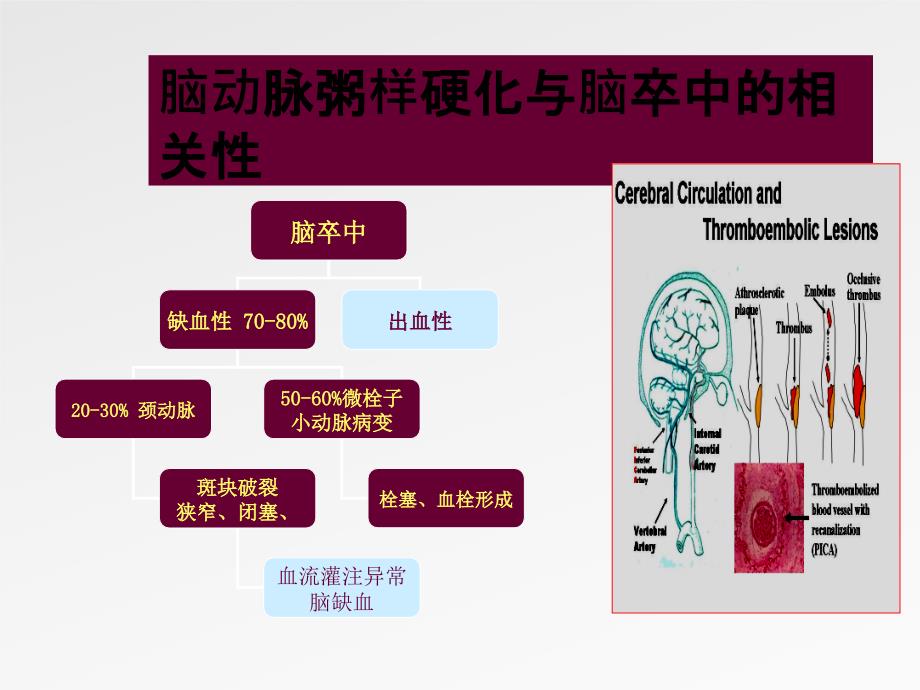 脑卒中高危人群的血管超声筛查与治疗评估_第4页