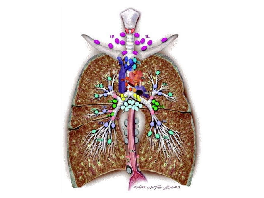 纵隔淋巴结IASLC课件_第2页