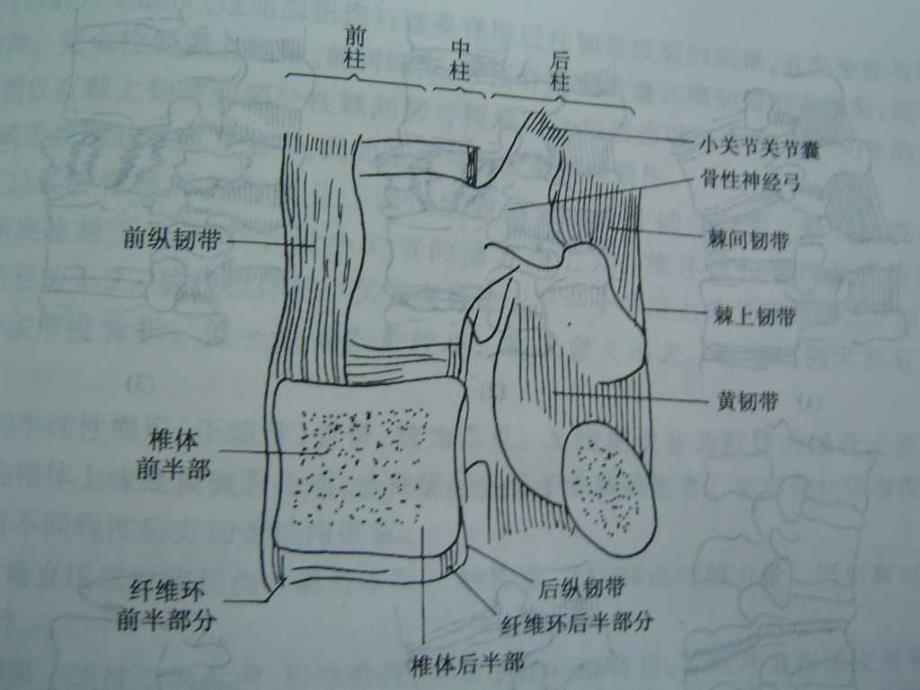 《脊柱和骨盆骨折》课件_第3页