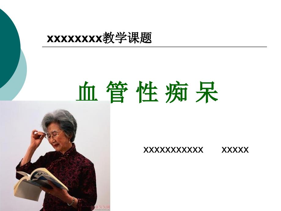血管性痴呆_第1页