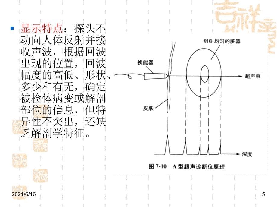 医学超声成像原理_第5页