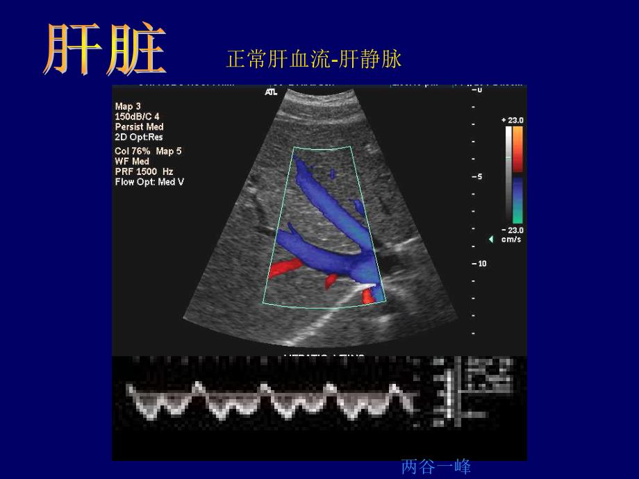 常见病B超图谱精选文档_第2页