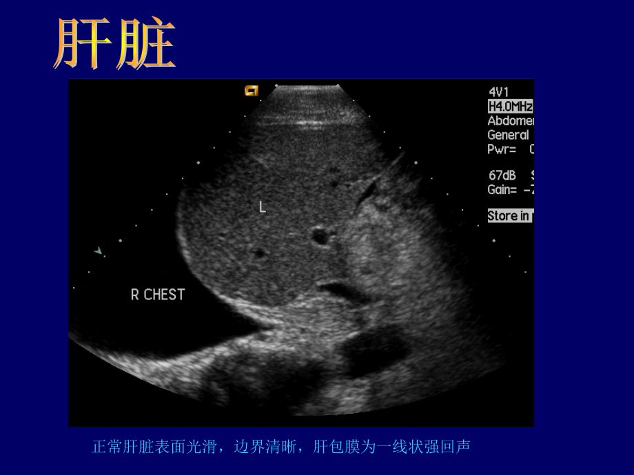 常见病B超图谱精选文档_第3页