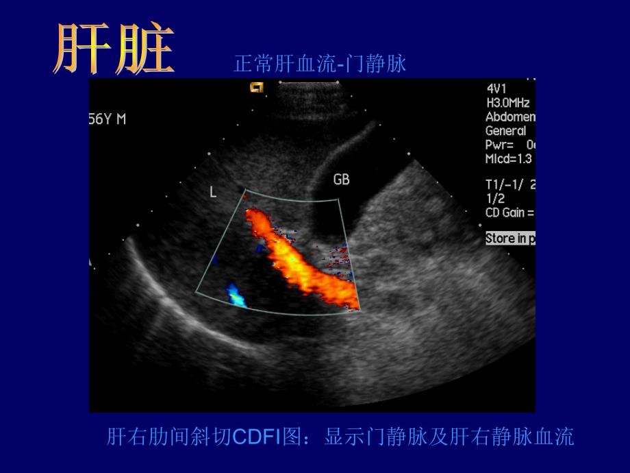 常见病B超图谱精选文档_第4页