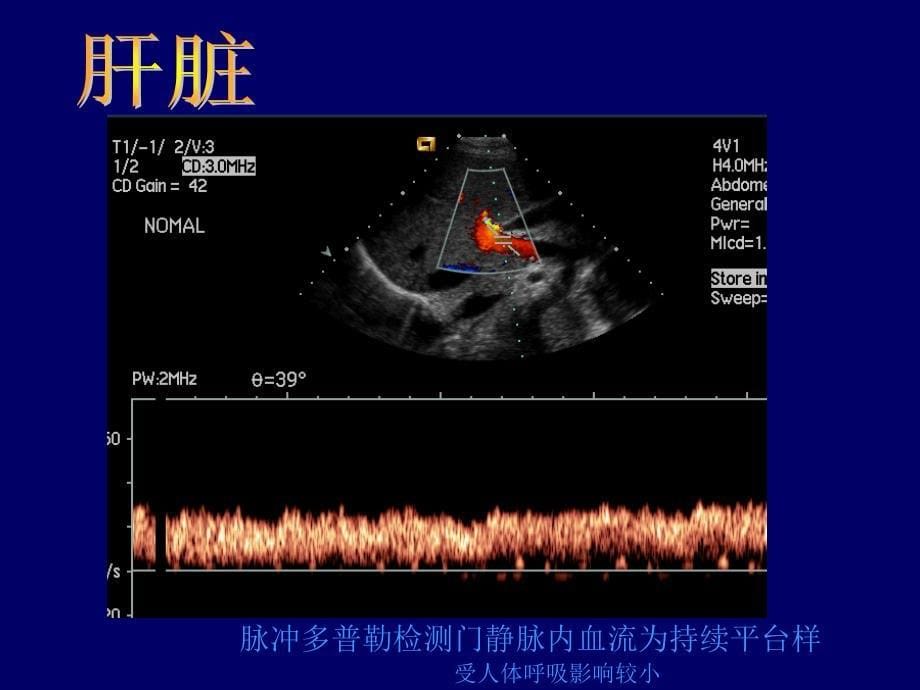 常见病B超图谱精选文档_第5页