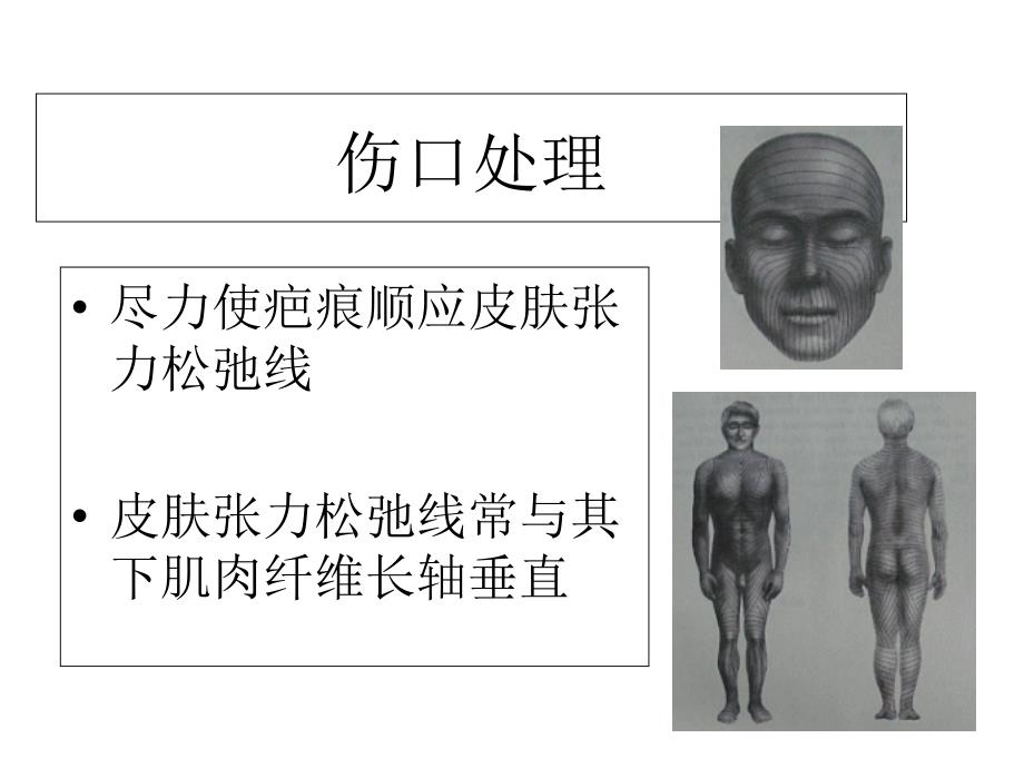 最新开放伤口处理PPT文档_第3页