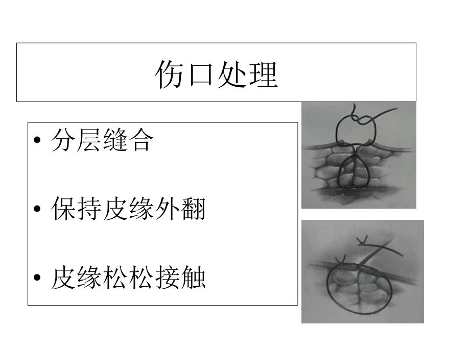 最新开放伤口处理PPT文档_第4页