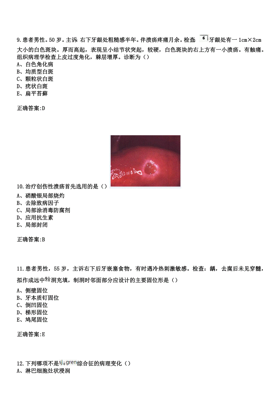 2023年扬州市广陵医院住院医师规范化培训招生（口腔科）考试历年高频考点试题+答案_第4页