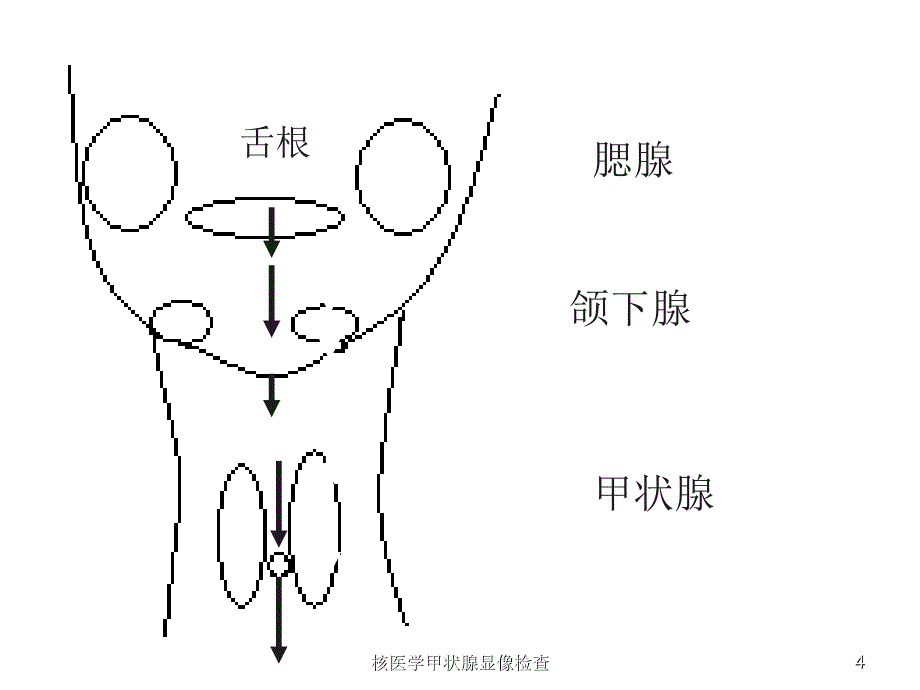 核医学甲状腺显像检查课件_第4页