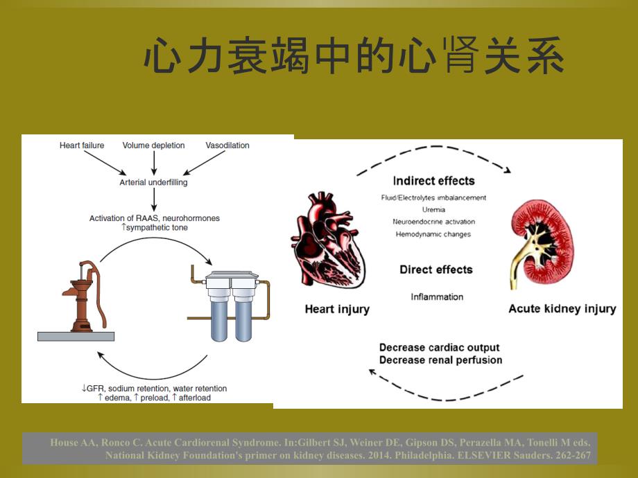 -利尿剂抵抗的处理策略_第2页