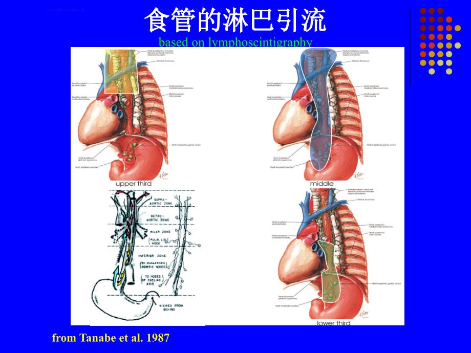 食管癌放射治疗靶区勾画--cuippt课件_第4页