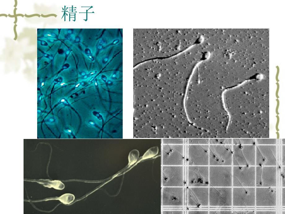 试管婴儿的步骤和护理ppt课件_第3页