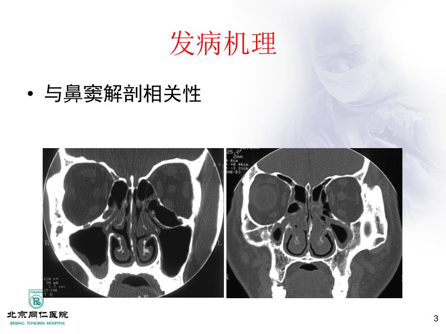 鼻窦炎及并发症PPT课件知识分享_第3页