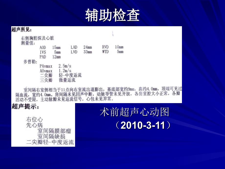 镜像右位心室间隔缺损封堵术一例_第4页