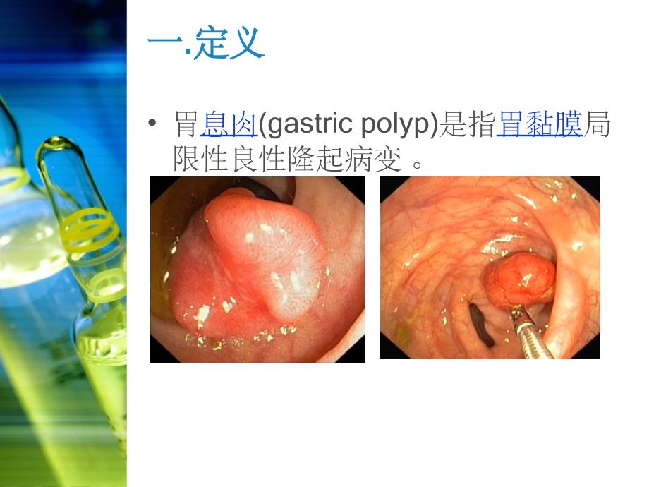 胃息肉内镜手术的护理ppt课件_第3页