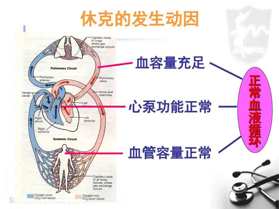 出血性休克.ppt_第4页